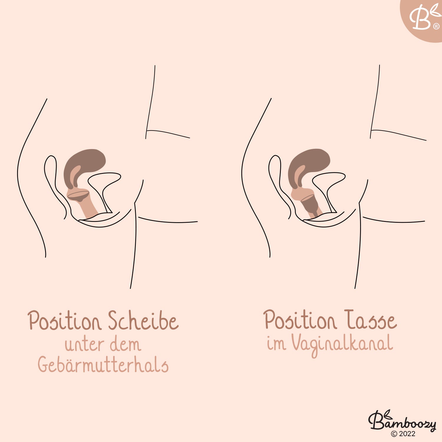 Bamboozy Menstruationsscheibe FemCare Disc